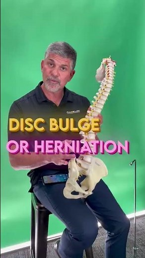 Disc Herniation VS Disc Bulge | what do you need to know?#herniation #medical #pain #neckpain