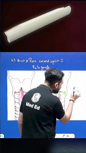 Why Surgeons Remove a Rib to Save the Airway! 🫁 | Cricoid Expansion Explained #pwmeded #mbbsstudents