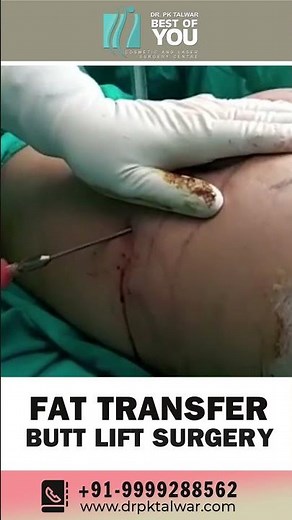 Buttock Augmentation with Fat Transfer | Butt Lift Surgery for Buttock Enhancement | Dr. PK Talwar