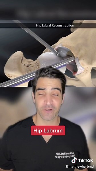 Effective Hip Labrum Tear Treatments and Surgery Options