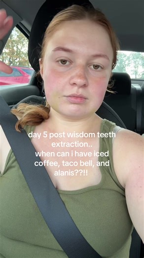 Coping with Wisdom Teeth Extraction Recovery