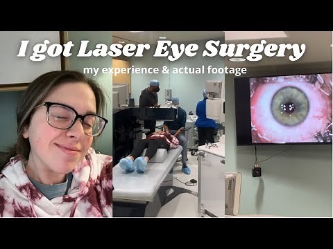 WHAT IT'S LIKE TO GET LASER EYE SURGERY | Advanced Surface Ablation (ASA)