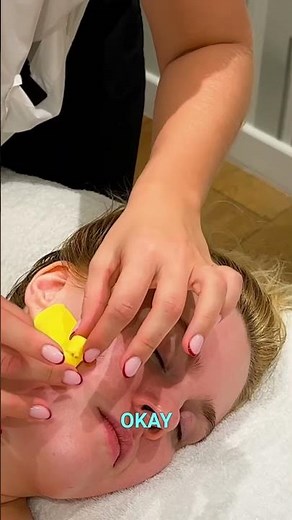 Wrinkle Eraser? Kinesio Taping Facial Magic Revealed!