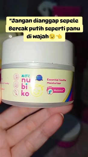 Bercak putih di wajah anak: penyebab dan cara menghilangkannya