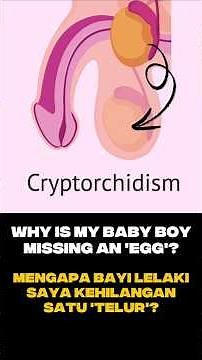 Undescended Testes in Children: Why Laparoscopic Surgery Is the Best Approach #paediatricsurgery