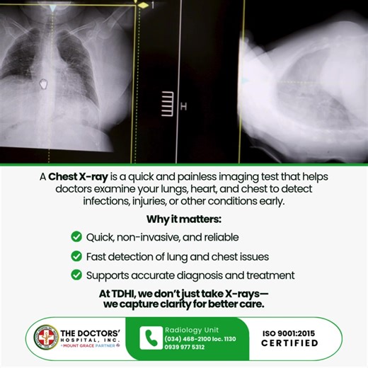 2.1K views · 12 reactions | "Breathing check? Let’s see what your lungs are saying. 贈" Contact us at: - Radiology & Imaging: (034) 468-2100 local 1130 or 0939 977 5312 #thedoctorshospitalbcd #CommittedToCare #thriveat75 | The Doctors' Hospital, Inc. | Facebook