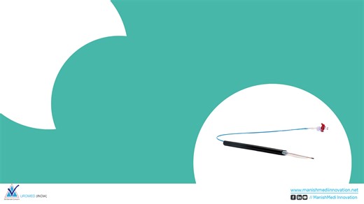 The Nephrotrack Balloon Dilator (Catheter) by Manish Medi allows safe and controlled dilation of the musculofascial tract and renal capsule, establishing a nephrostomy tract during percutaneous procedures. Compatible with Amplatz Sheath for smooth instrument passage. Order yours from Manish Medi Today! https://www.manishmediinnovation.net/ book a free consultation: - 91- 74836 72292 / 8310484103 / 8660817009 Email: marketing@manishmediinnovation.net Toll-free number: 919355519370 #ManishMedi #Ne