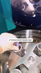 Platelet-Rich Plasma (PRP) for Under-Eye Rejuvenation