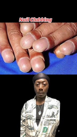 1.9K reactions · 146 comments | Nail Clubing #clubbing | Dre TheHealer Threesixnine | Facebook