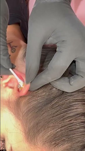 Helix Piercing Bump Care | Cartilage Piercing Healing Routine 💧