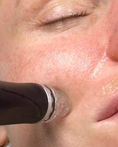 11K views | Turn skin confidence into client loyalty and revenue with...