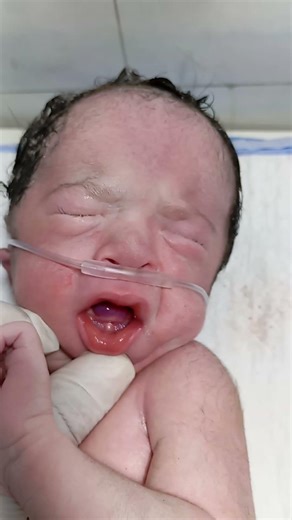 look it the new born baby mooth