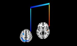 Reaching the Brain With Music | Neuroscience