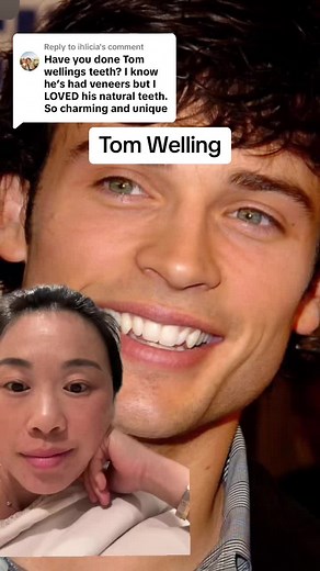 Tom Welling Veneer Check: Smile Transformation Revealed!