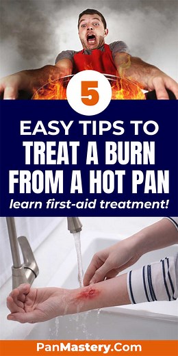5 Steps to Treat a Burn from a Hot Pan (First-Aid, Reminders) | Pan Mastery