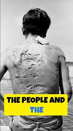 Hiroshima: The Day the World Changed Forever #history #ww2 #facts