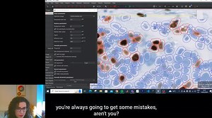 06_Detecting_Cells_with_QuPath