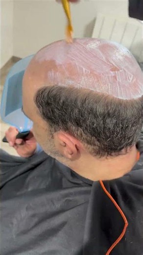 #toupee #toupet #prothesecapillaire