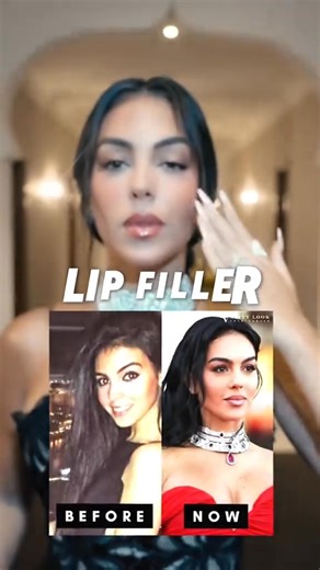 The Georgina Glow-Up Case Study” Let’s talk Georgina Rodriguez — a true evolution of beauty, refinement, and science. 🖤 Over the years, her transformation whispers of subtle | Doctorhasia