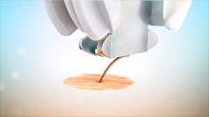 Watch Emjoi AP18 Emagine Epilator on Amazon Live