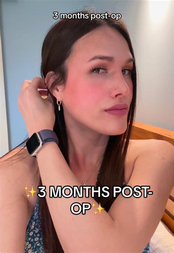 3 Months Post-Op Rhinoplasty Journey and Future Plans