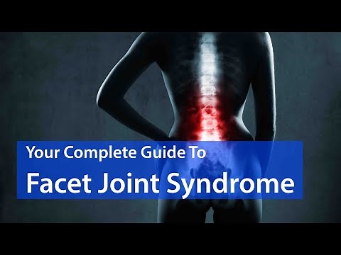 Is Facet Joint Syndrome Causing Your Back Pain? EVERYTHING YOU SHOULD KNOW