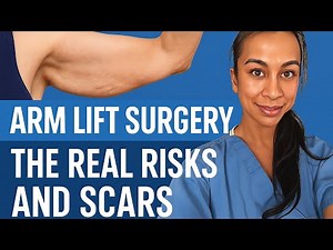 Brachioplasty: The Truth About Arm Lift Surgery, Scars, Risks, Recovery, and Trade-Offs