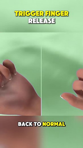 #surgery #3d #3danimation | Surgery Page