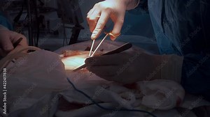 Doctors in blue uniforms use medical instruments and metal thread to suture human skin during minimally invasive surgery. Close-up hands in sterile gloves, covered with blood.