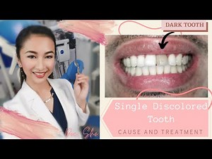 How to treat a discolored or dark tooth ? (zirconia crown)