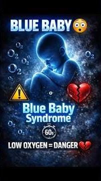 Blue baby syndrome 😳 Low oxygen can change body color! #DidYouKnow #Science