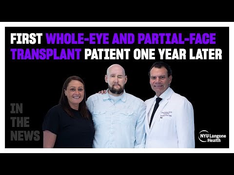 One Year Later: First Whole-Eye and Partial-Face Transplant Patient Makes Remarkable Progress