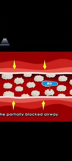 **Why Do We Snore While Sleeping? 😴**