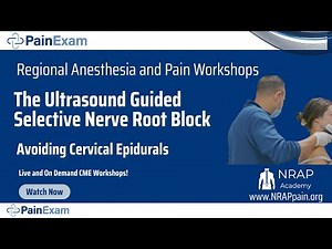 Avoiding Cervical Epidurals: Ultrasound Guided Cervical Selective Nerve Root Block- NRAP Academy