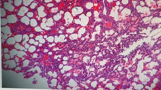 蔡司显微镜以及作图软件axio vision使用方法