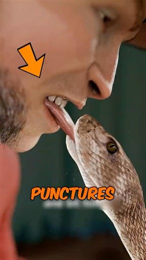 HOW BAD WILL IT GET If A Venomous Snake Bites You?