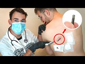 FLEXI FINDS 3 CHIP in BFF KMAN'S SKIN IMPLANTED by the PHANTOM!!!