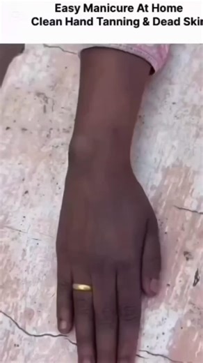 Easy hand whitening tips for glowing hands!✨ #HandWhitening #YTShorts