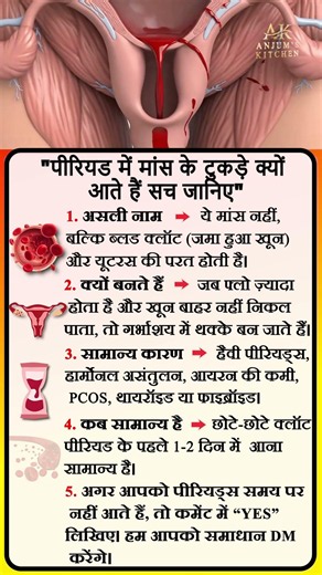 Wondering why you see “meaty” pieces during your period? Know the real reason. #shorts