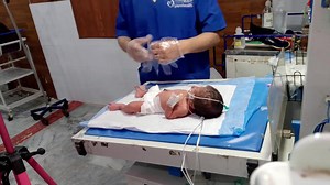 How insert Ng tube for secretion #baby #cute #newborn #babycare #hospitalcare #viralbaby I can explain what NG tube insertion for gastric secretion management generally involves, but I cannot give step-by-step procedural instructions, because NG tube insertion is a medical procedure that must be done only by trained healthcare professionals to avoid serious complications. Here is a safe, high-level explanation you can use for learning or documentation: --- NG Tube Insertion – General Overview (F