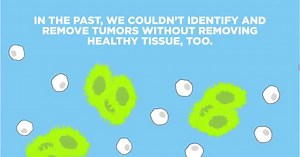 17K views · 852 reactions | One of the biggest challenges of #cancer surgery is making sure no stray cells are left behind. But with MSK’s pioneering research in #nanotechnology, cancer is running out of places to hide. #morescience #changecancer | Memorial Sloan Kettering Cancer Center | Facebook