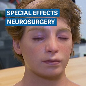 221K views · 277 reactions | Surgeons are getting better at performing complex brain operations—by turning to Hollywood. | Quartz | Facebook