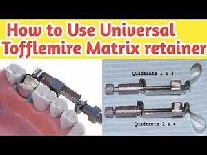 How to use Universal Tofflemire Matrix retainer