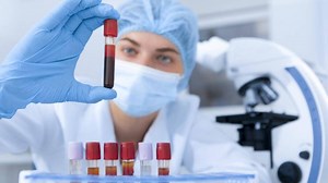 Todo lo que debe saber sobre la anemia; síntomas, tratamiento y cómo prevenirla