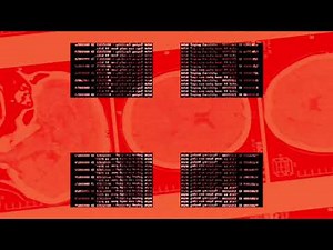 Cancel x AVLM - Chaos Module (Visual Video)