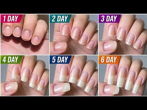 5 EFFECTIVE REMEDIES || grow nails in just 3 days ||faster nail growth tips || How to grow Nails