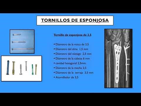 RECONOCE LOS TORNILLOS DE LA OSTEOSÍNTESIS, TORNILLOS DE ESPONJOSA Y CANULADOS. (2° parte)