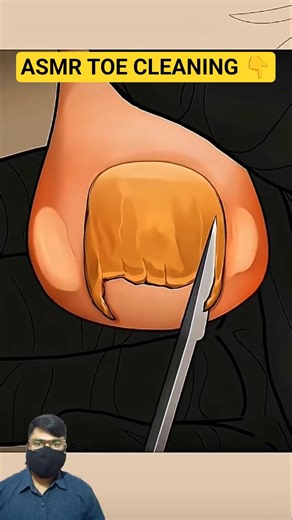 ASMR Extreme Toe Cleaning & Restoration 🦶✨ #shorts #asmr