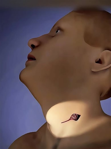 How Neck Disc Replacement Relieves Nerve Pain #cervicaldiscreplacement #necksurgery #NervePain #spinehealth #orthopedicsurgery