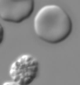 New studies show how malaria parasite grows and escapes from red blood cells